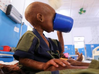 Krisis kelaparan anak di Somalia semakin parah setelah adanya pemotongan bantuan, kata UNICEF